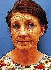 Ex-day care owner faces 27-count indictment